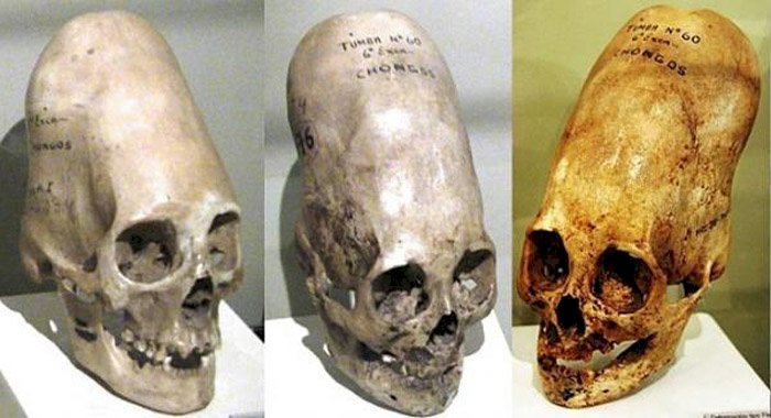 Misterul craniilor alungite – Moștenirea genetică a unei rase necunoscute